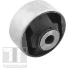 Tedgum | Lagerung, Differential | TED70760