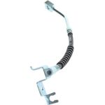 Bremsschlauch 1 987 476 149