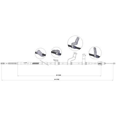 17.6075 Seilzug, Feststellbremse