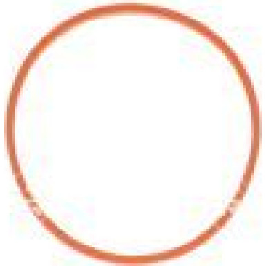 NRF Drosselklappenstutzen EASY FIT 408022